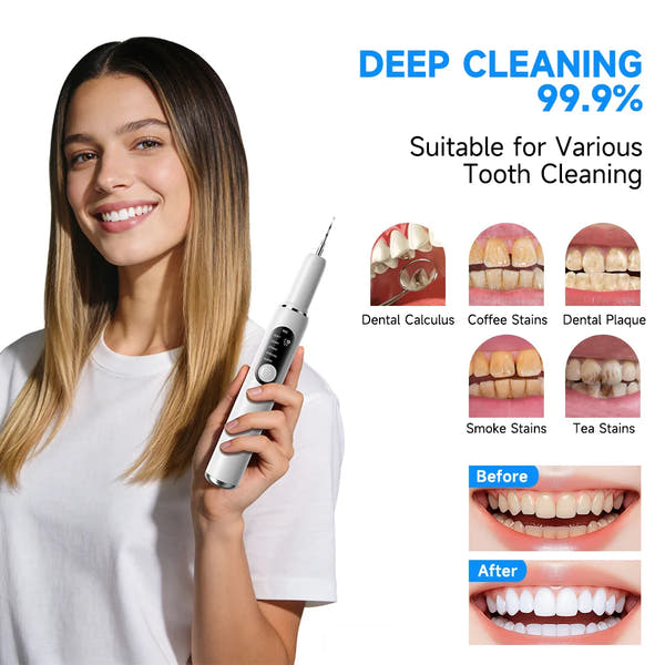 Alerion™ - Ultrasonic Plaque Remover