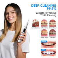 Alerion™ - Ultrasonic Plaque Remover